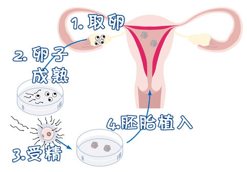 42岁高龄成功案例